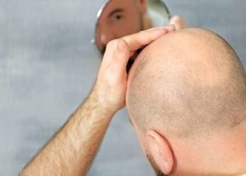 علاج للصلع ونمو الشعر