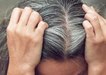 لماذا يتحول الشعر إلى الأبيض؟ طبيب يوضح دور الميلانين وخطورة نتف الشعر الأبيض
