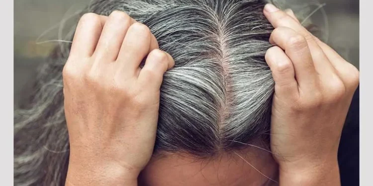 لماذا يتحول الشعر إلى الأبيض؟ طبيب يوضح دور الميلانين وخطورة نتف الشعر الأبيض
